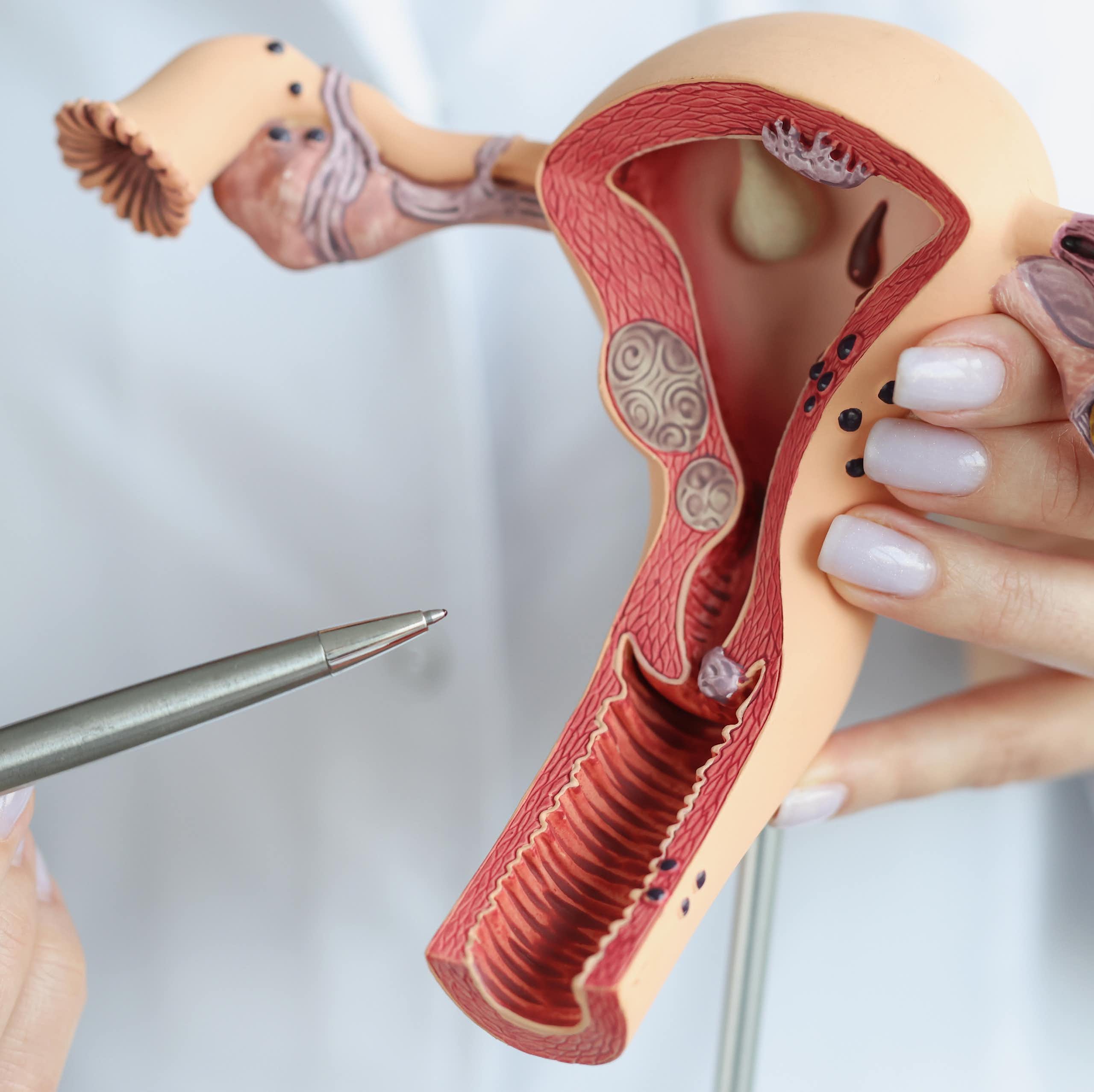 El bueno, el feo y el malo: el endometrio