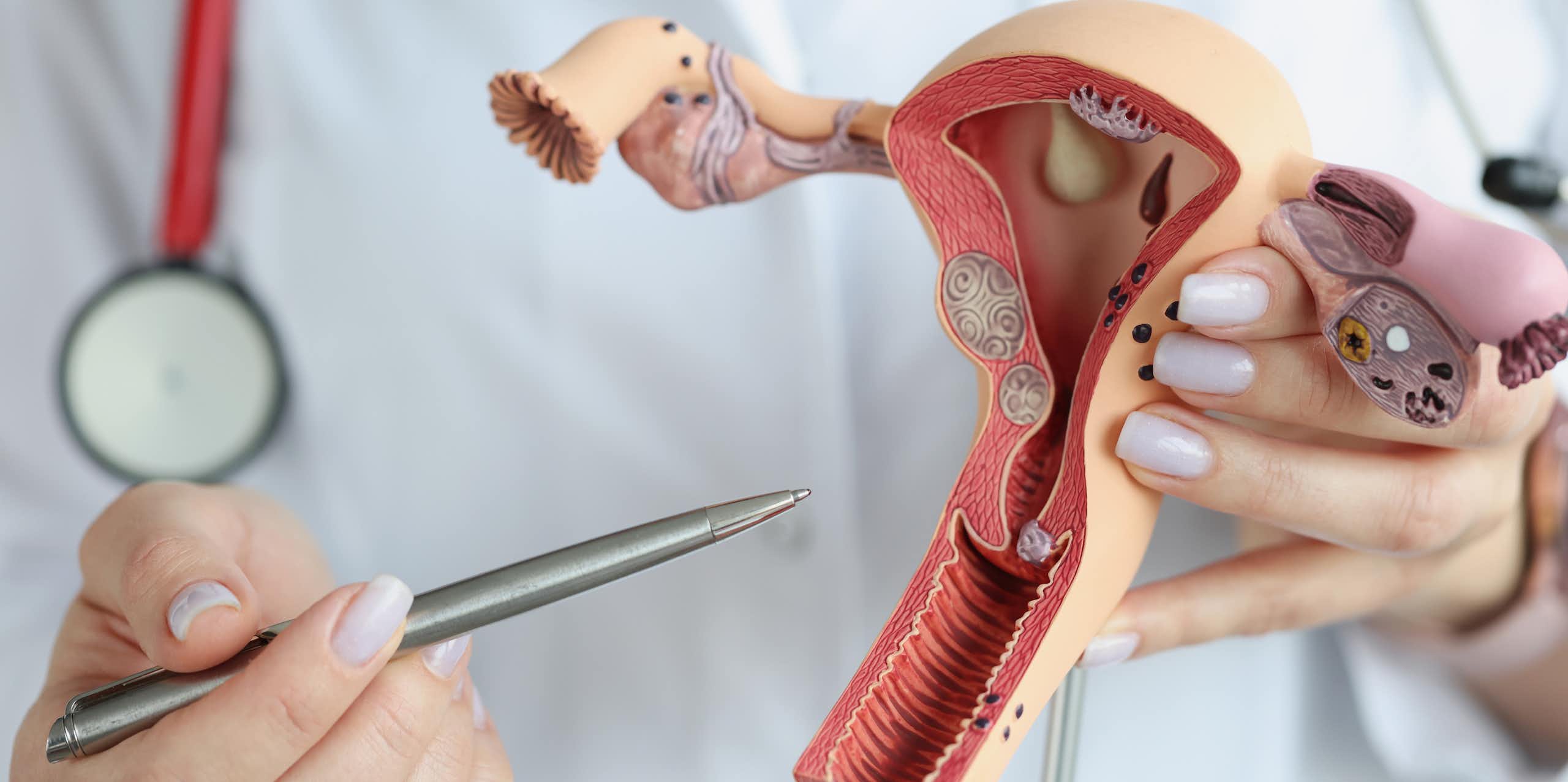 El bueno, el feo y el malo: el endometrio