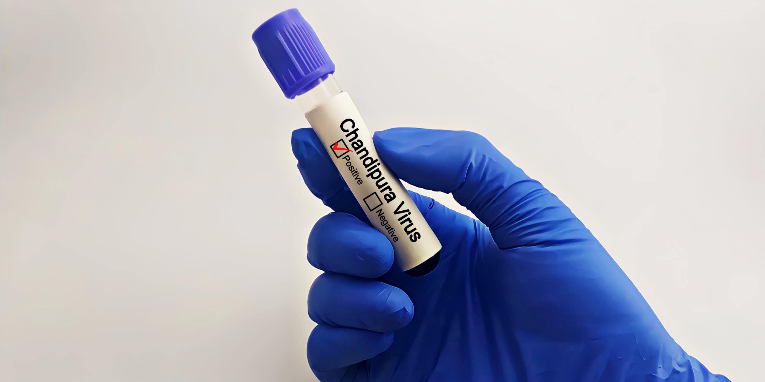 ¿Qué es el  virus mortal Chandipura que afecta a la India?