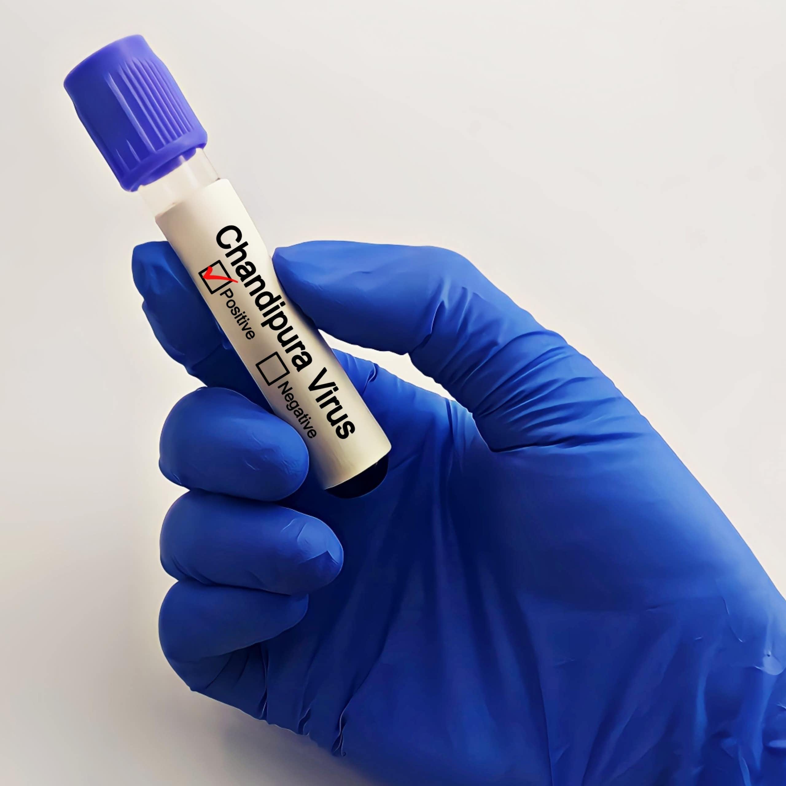 ¿Qué es el  virus mortal Chandipura que afecta a la India?